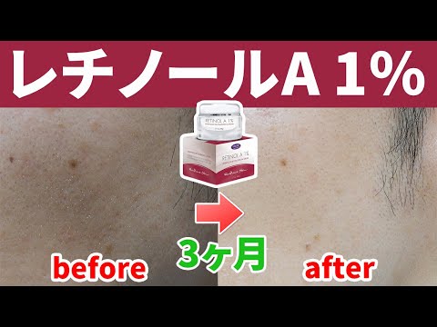 130181-vyZ8ehmKxCE