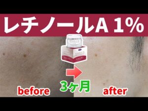 130181-vyZ8ehmKxCE