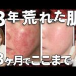 131339-ibS29oB_P-Q