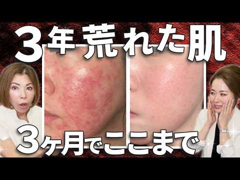131339-ibS29oB_P-Q